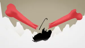 كيف تؤثر كسور العظام في كبار السن؟
